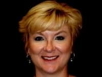 Konig Center for Cosmetic & Comprehensive Dentistry smile photos